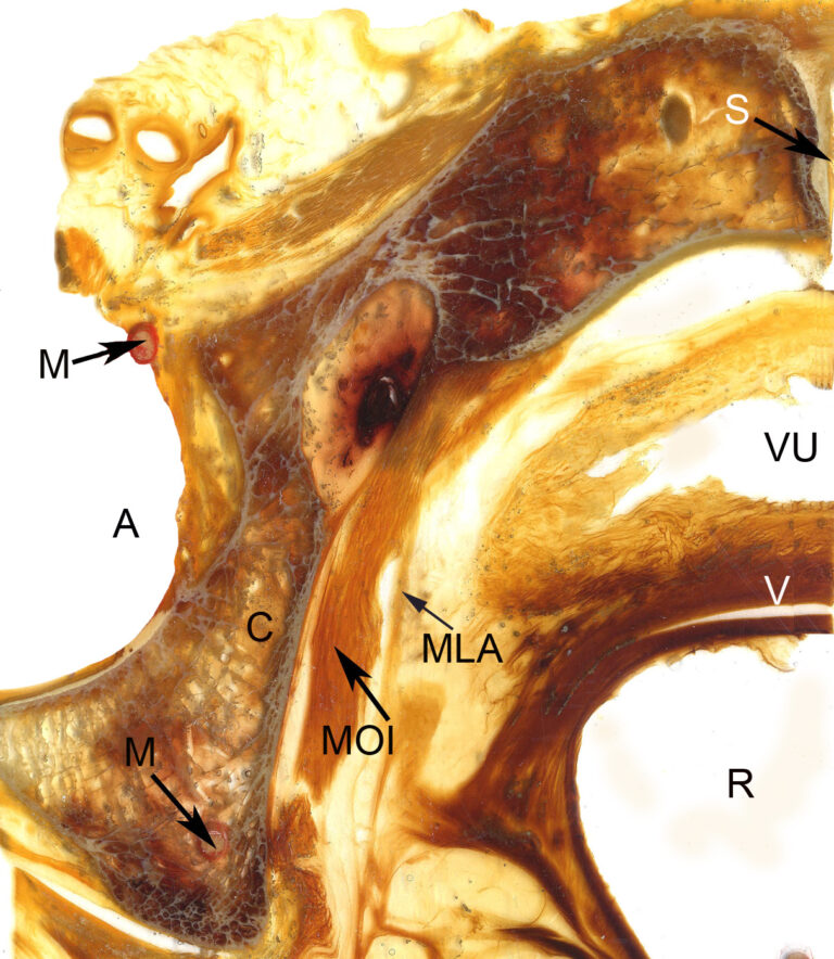 Three dimensional reconstruction of a female pelvis using plastinated
