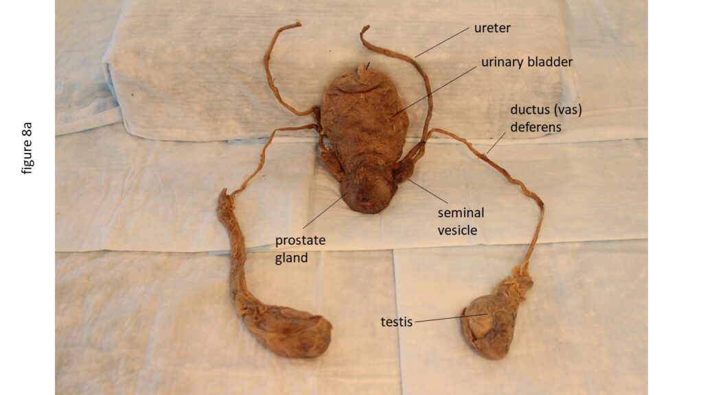 Method for Creating Interactive Plastinated Models of the Male and