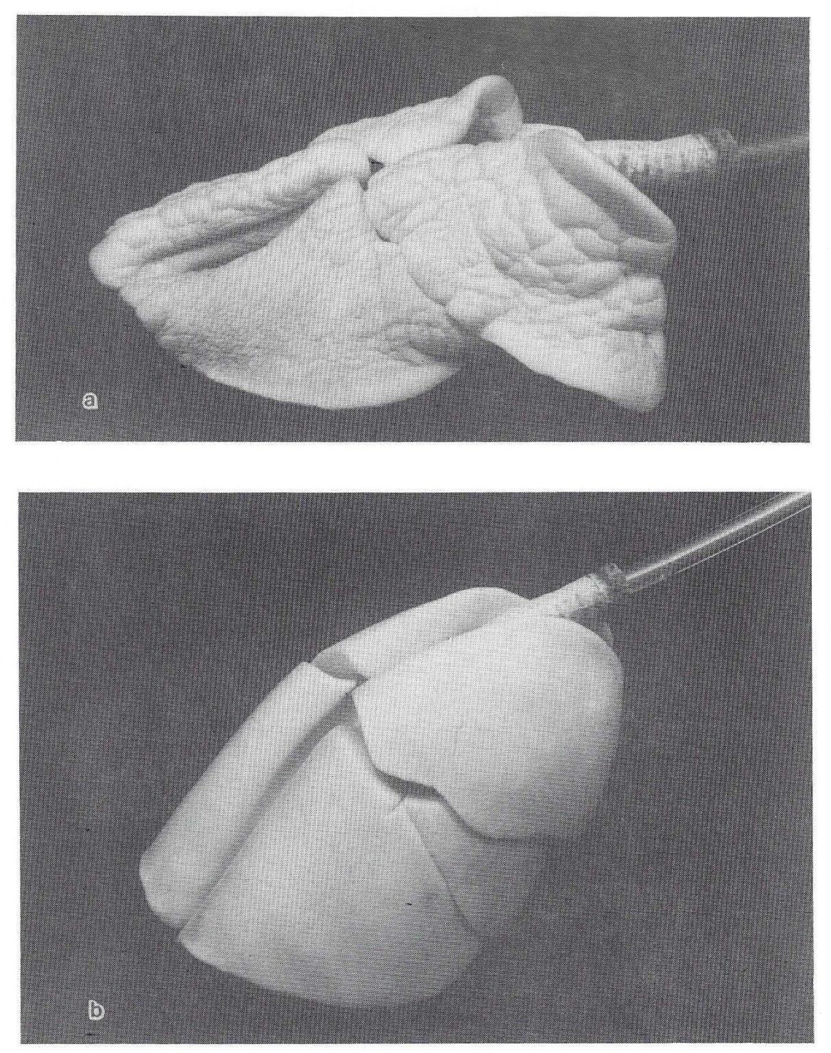 A New Method For Preservation of Lungs - The Journal of Plastination